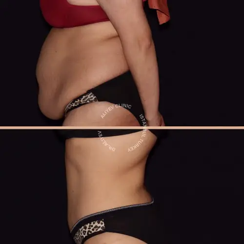 body-result2